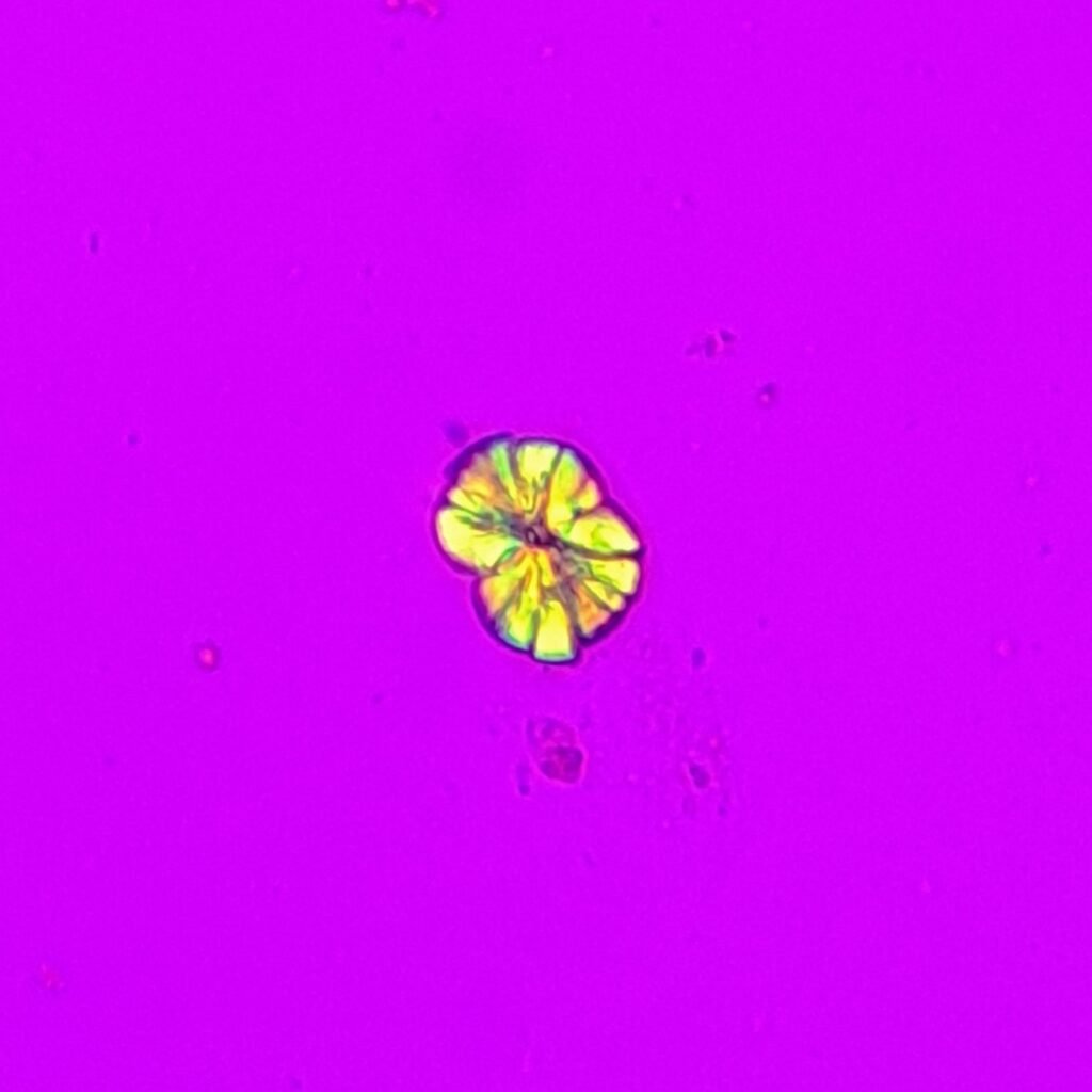 Leucine Crystals (Polarized) 