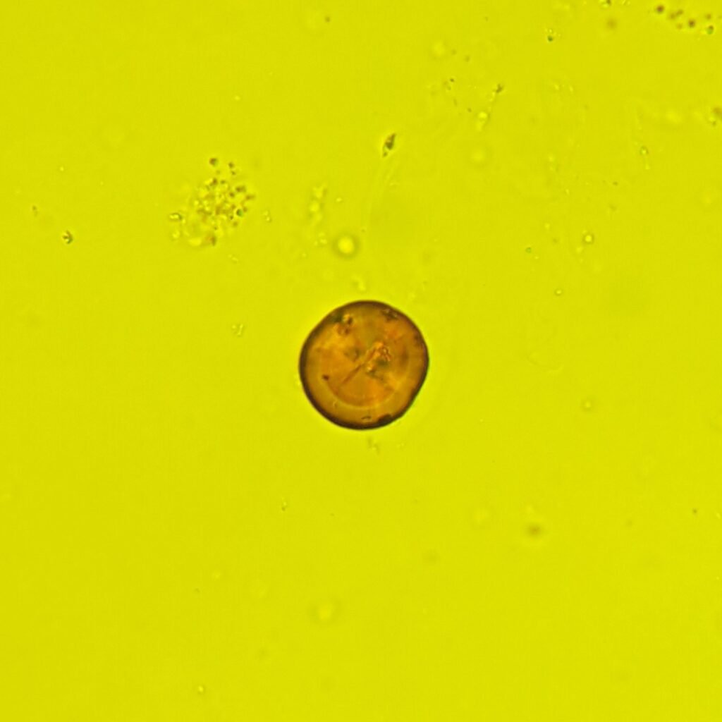 Leucine Crystals