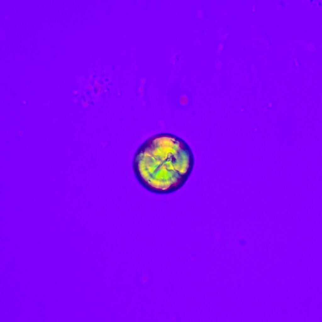 Leucine Crystals (Polarized) Pseudo-Maltese cross