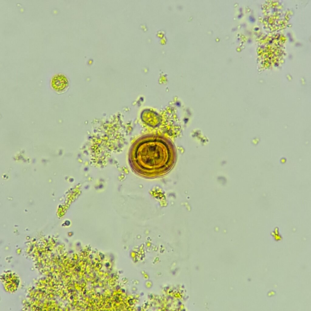Leucine Crystals
