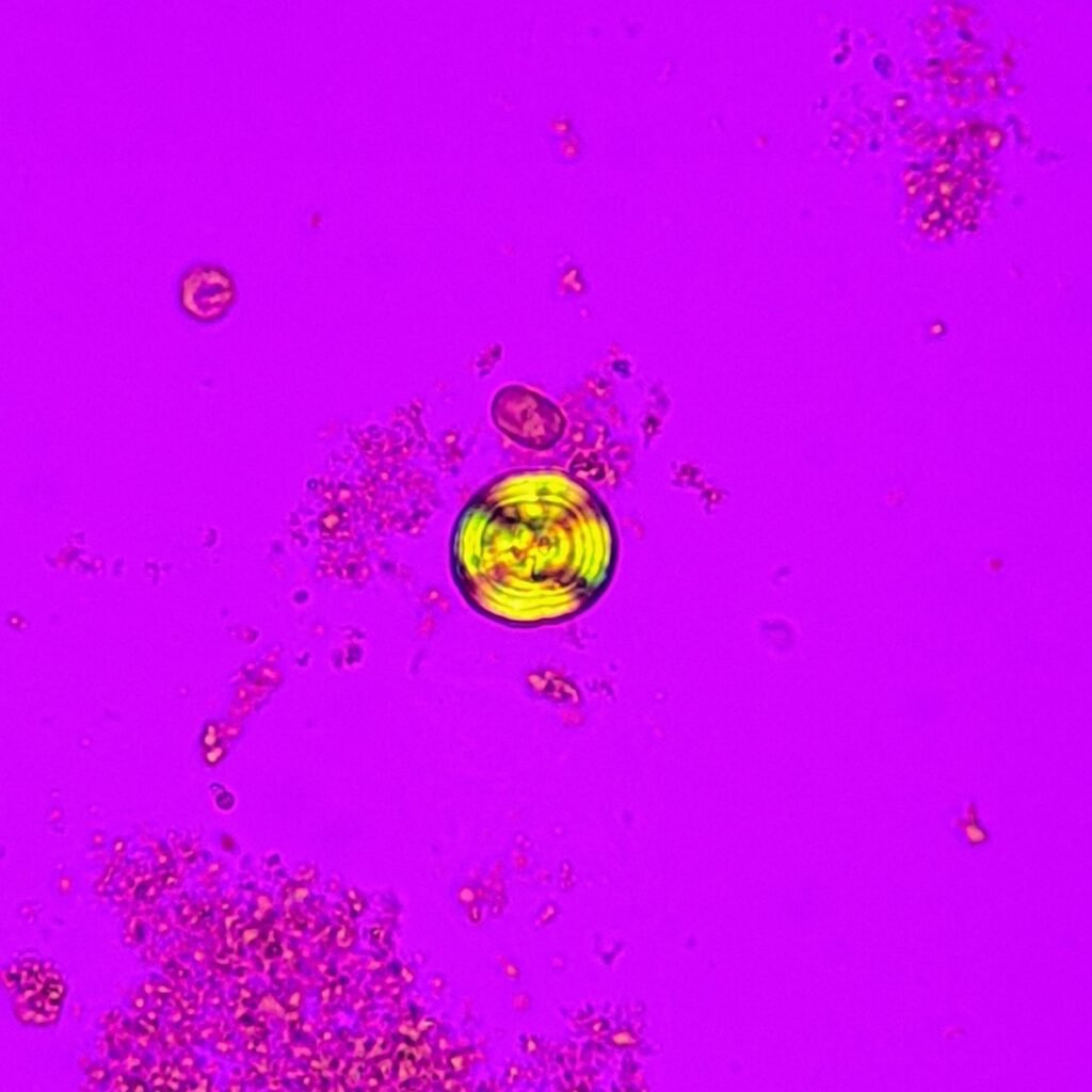 Leucine Crystals (Polarized) Pseudo-Maltese cross