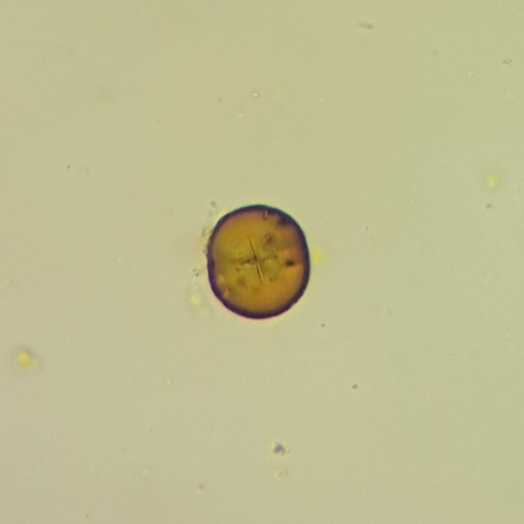 Leucine Crystals