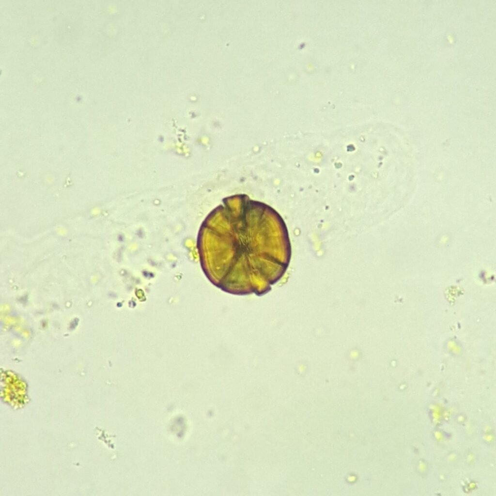 Leucine Crystals