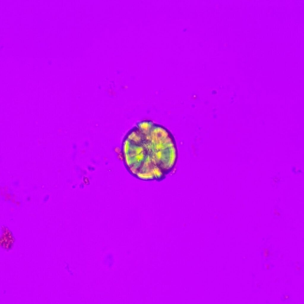 Leucine Crystals (Polarized) Pseudo-Maltese cross