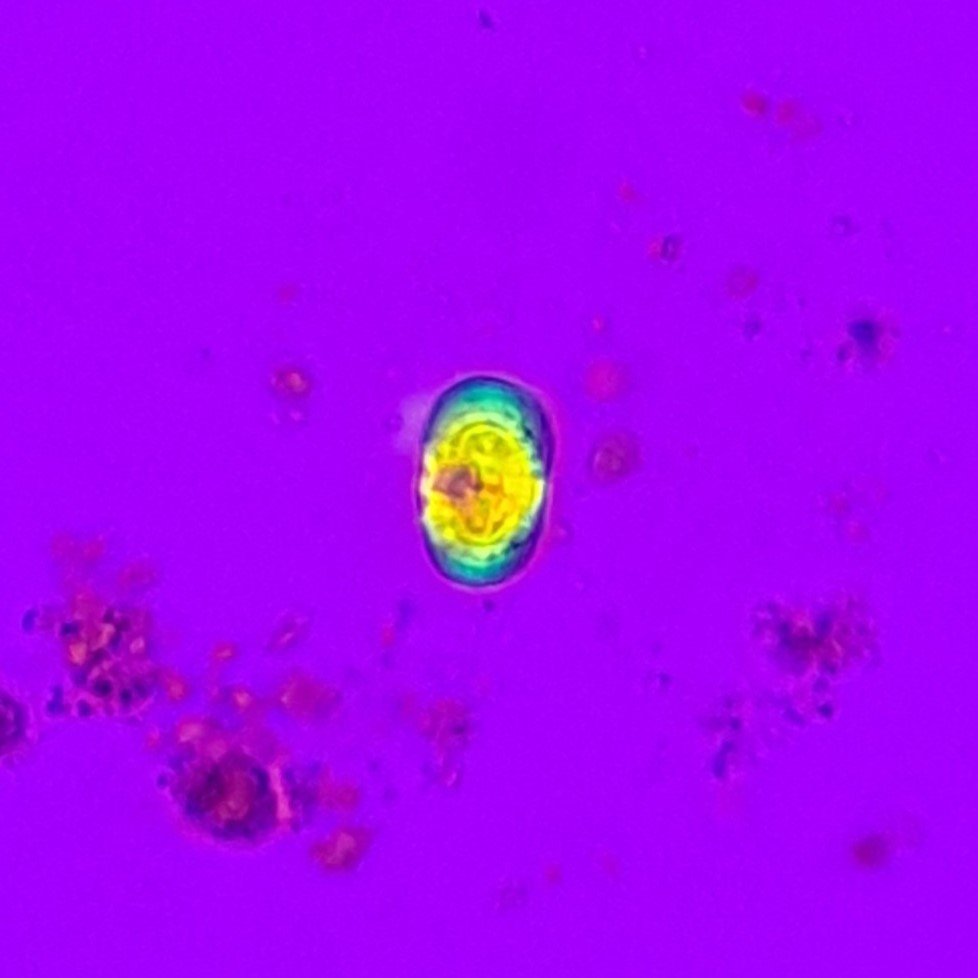 Leucine Crystals (Polarized) 