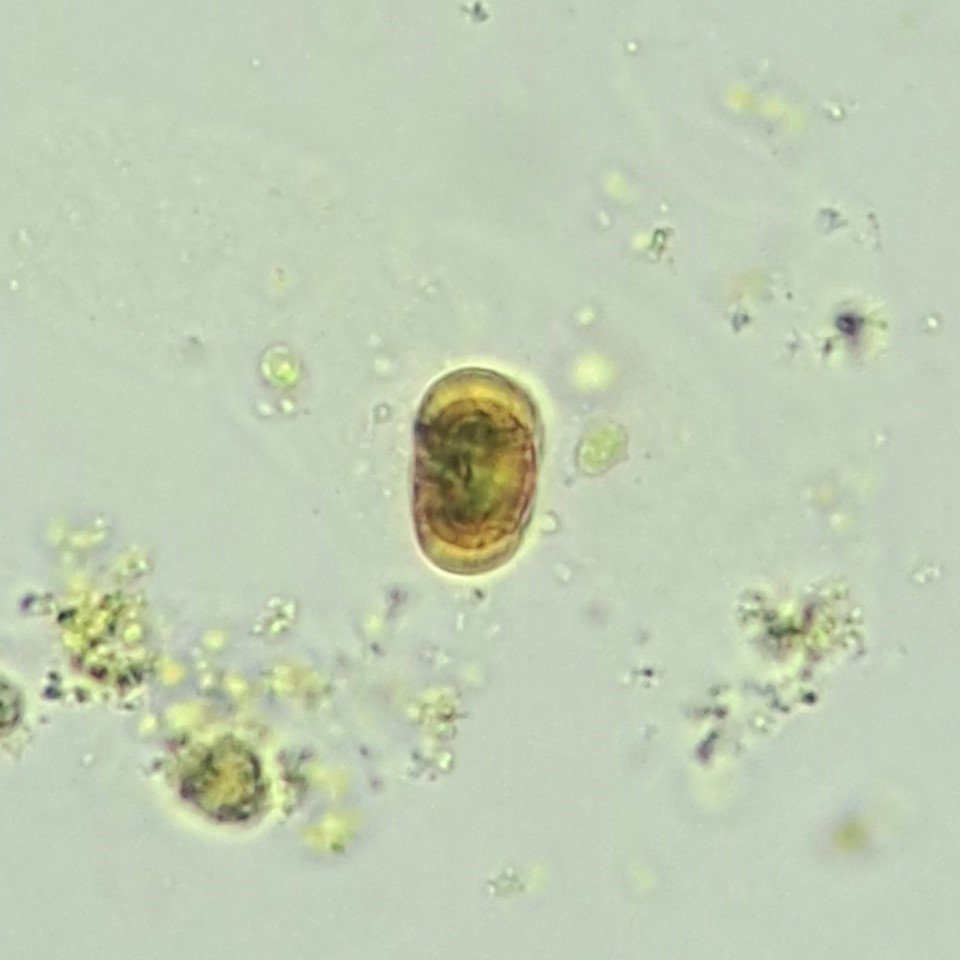 Leucine Crystals