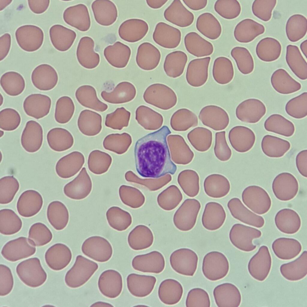 activated lymphocytes