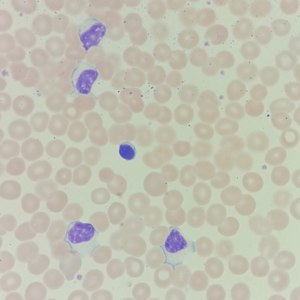 activated lymphocytes