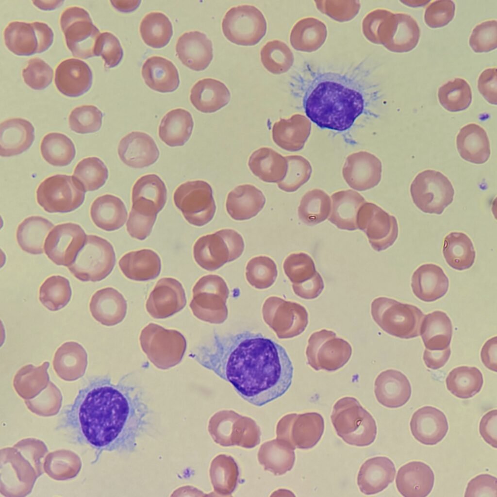 Hairy Cell, Lymphocyte, White Blood Cell