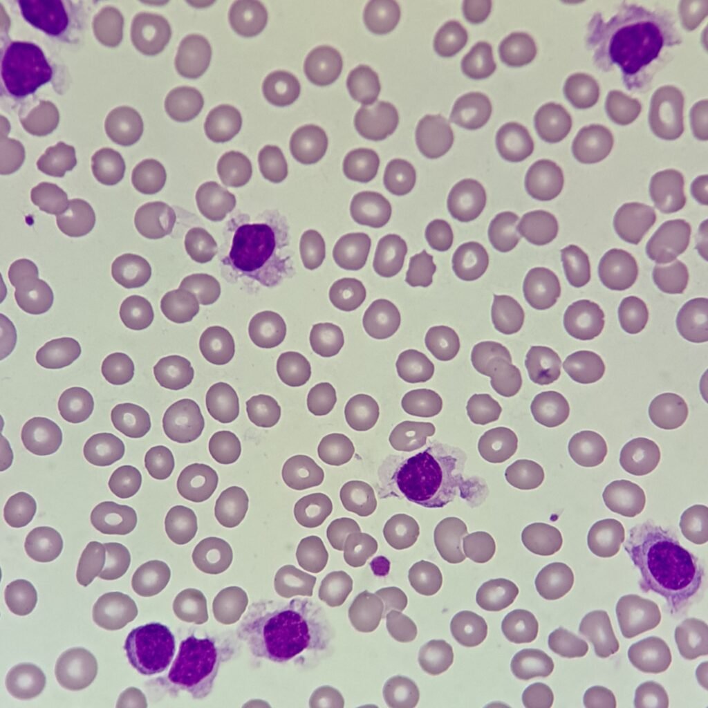 hairy cells