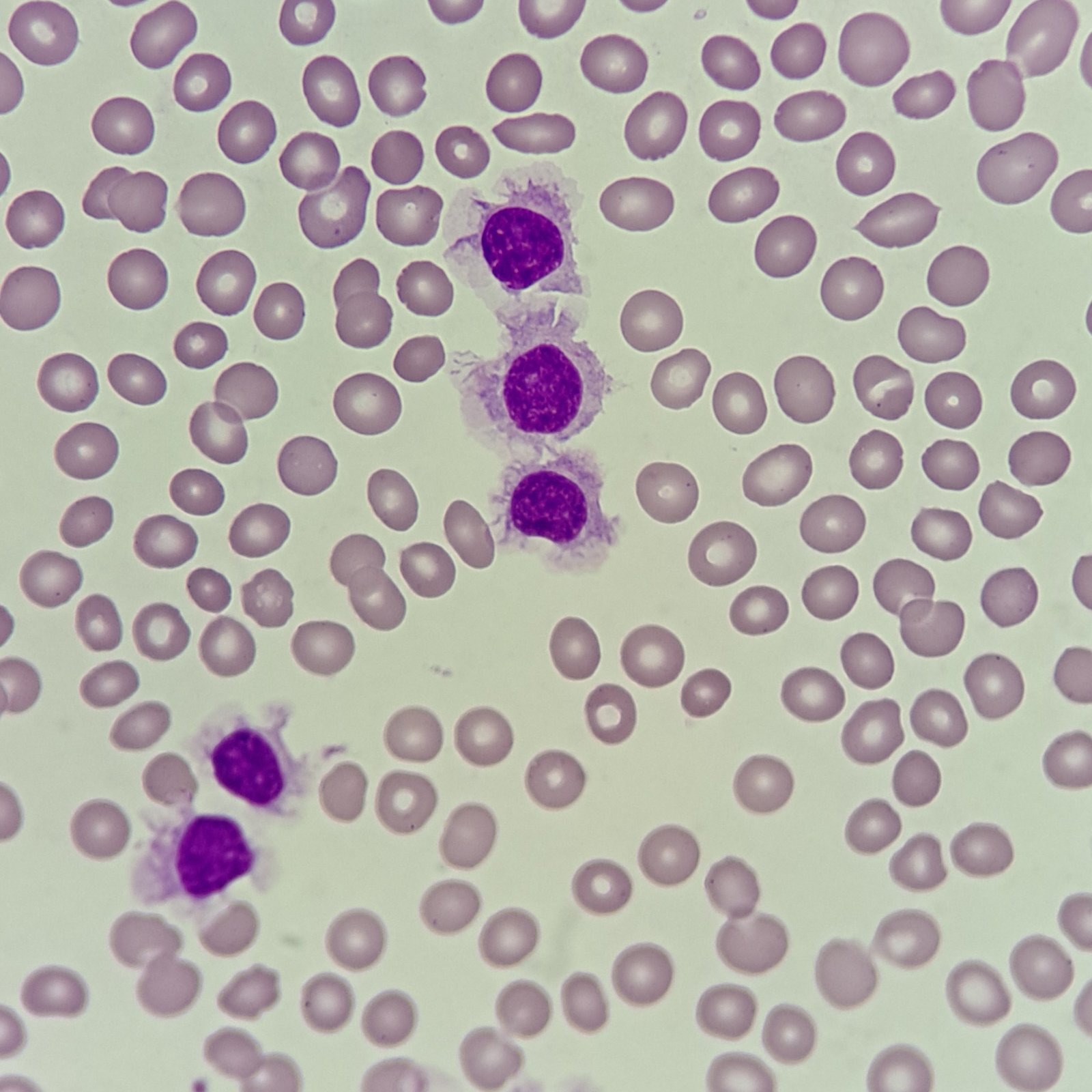 hairy cells