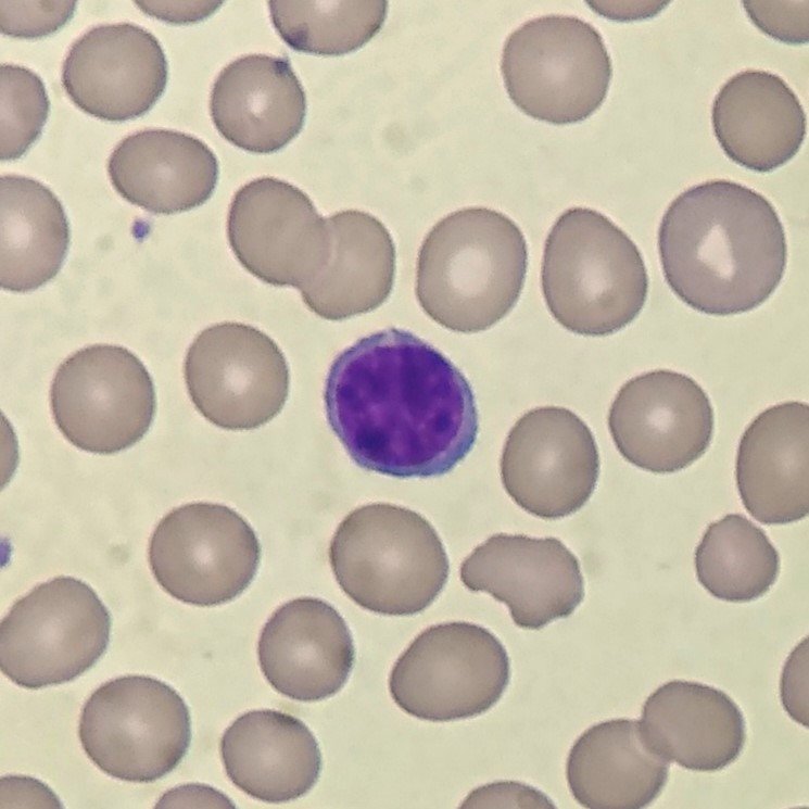 white blood cell: small resting lymphocyte