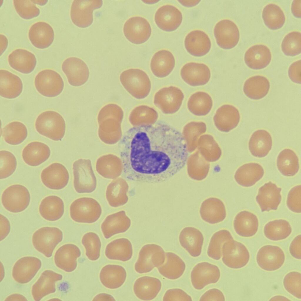 Metamyelocyte, Immature Neutrophil, White Blood Cell