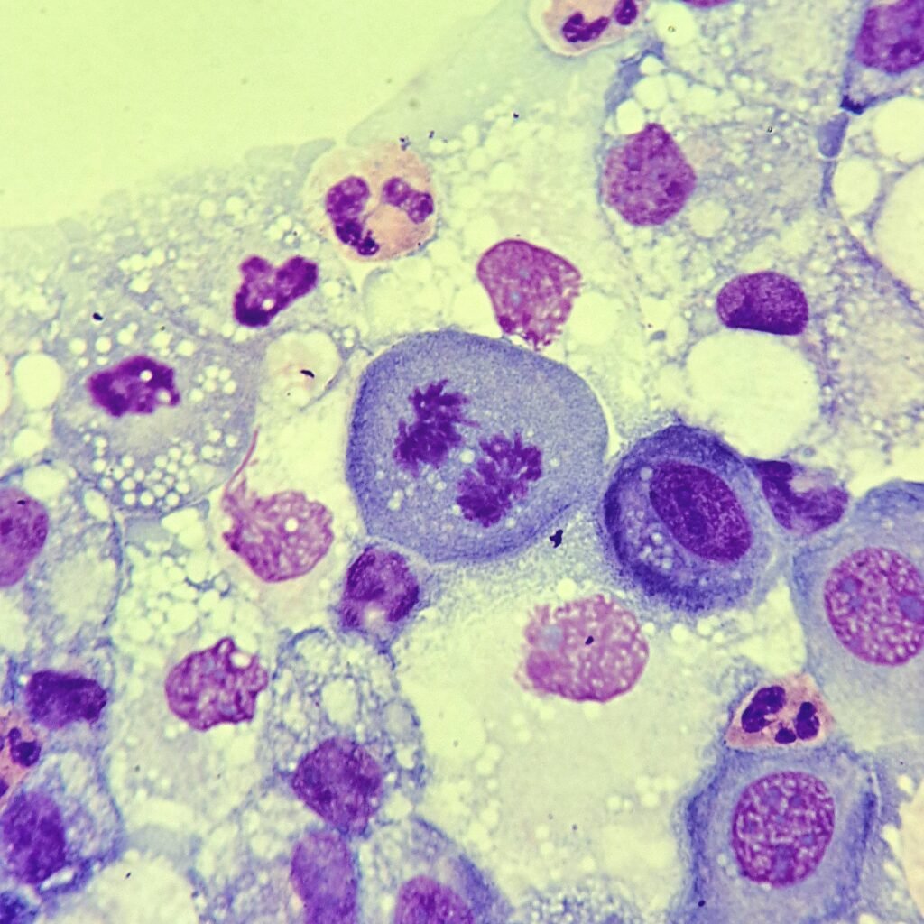 mitotic figure in body fluid