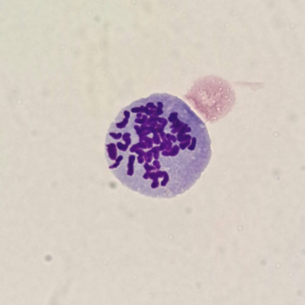 mitotic figure in body fluid