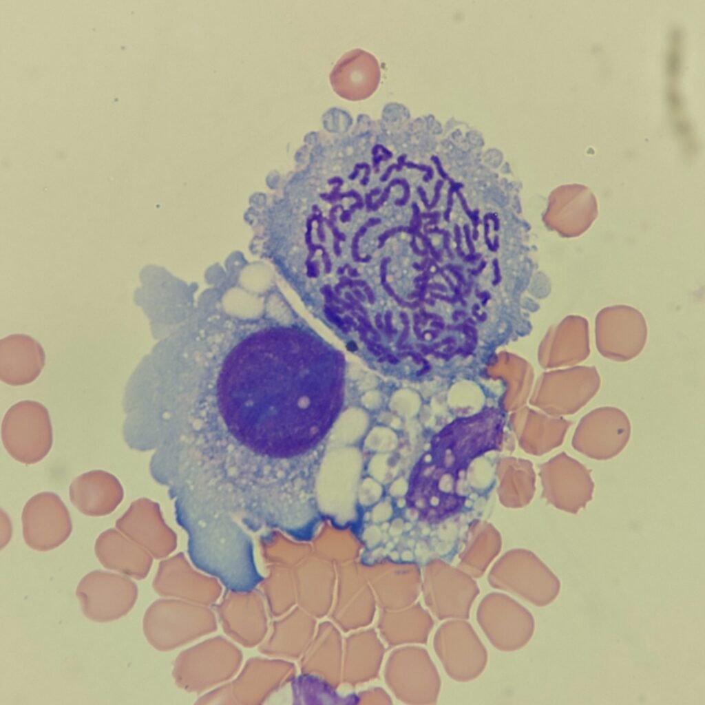 Mitotic Figure in Body Fluid
