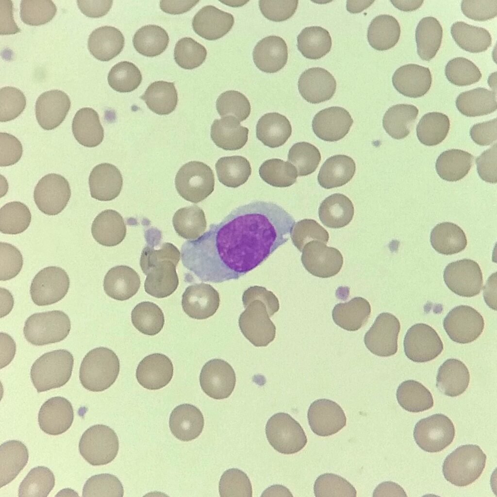 monocyte