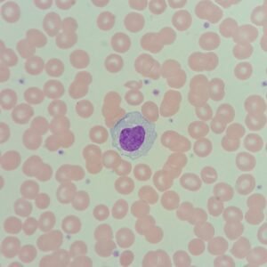 Monocytes: Identification & Differentiation