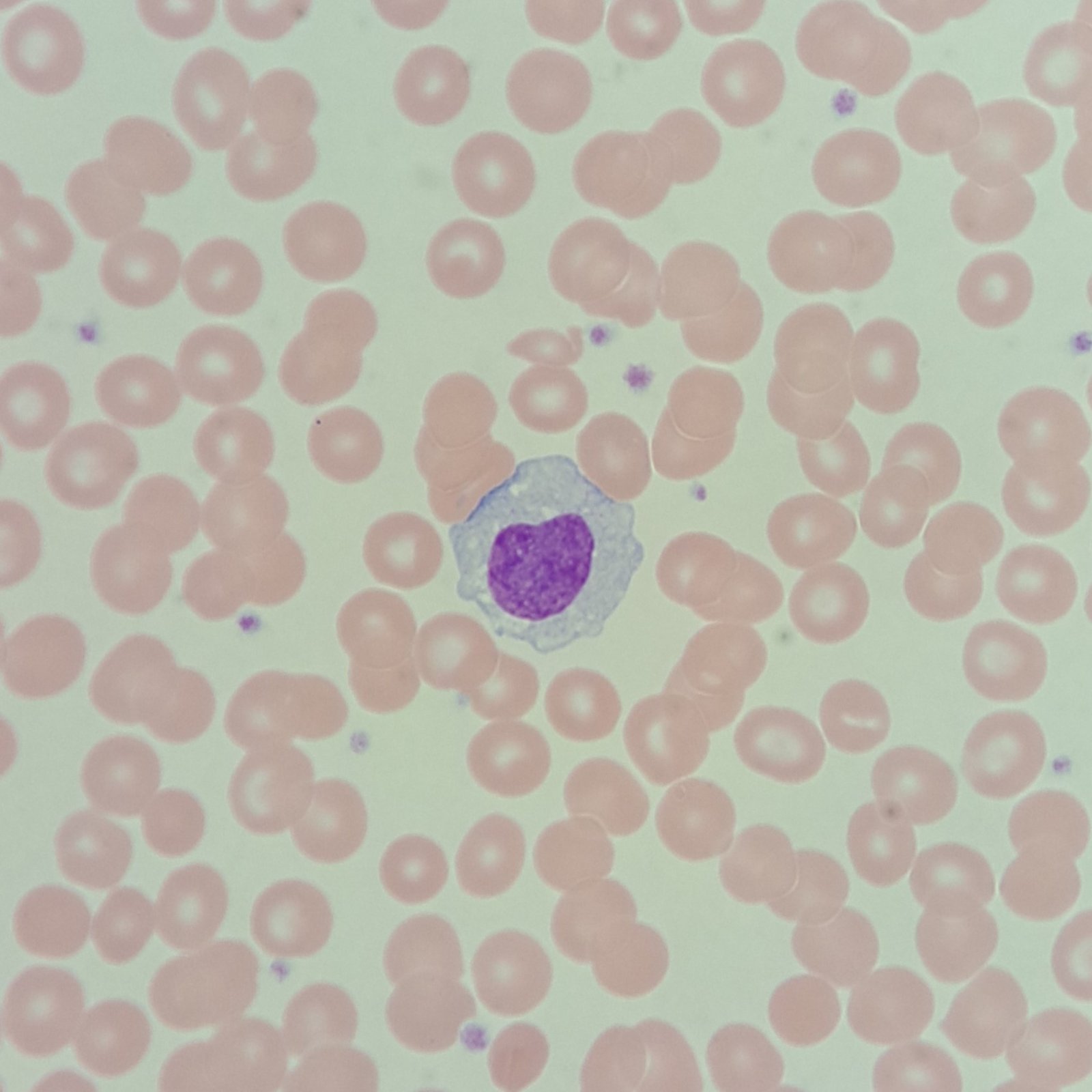 white blood cell: monocyte