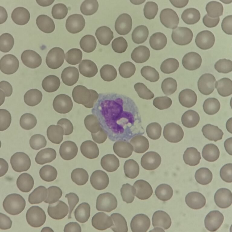 Monocyte Lab Model Monocytes: Identification & Differentiation