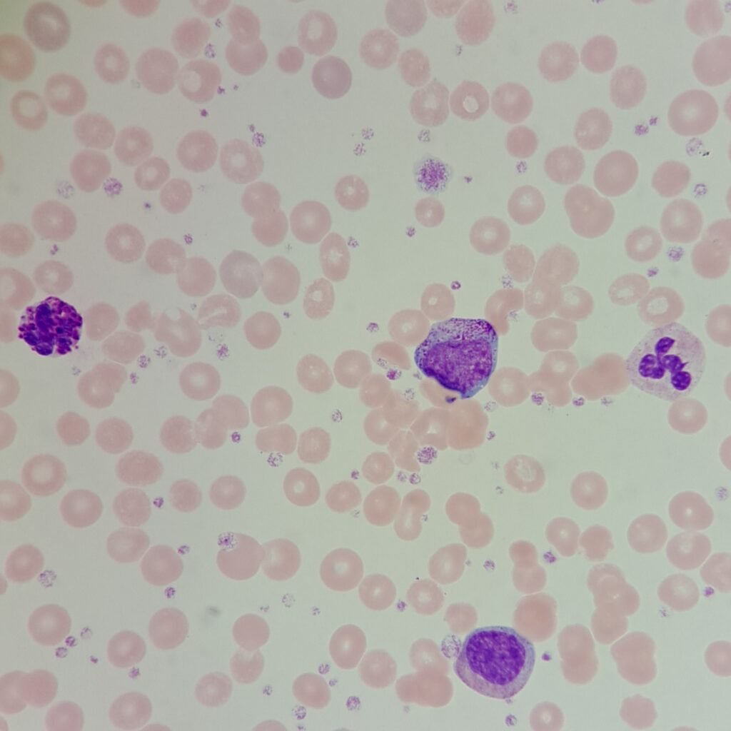An immature neutrophil: myelocyte