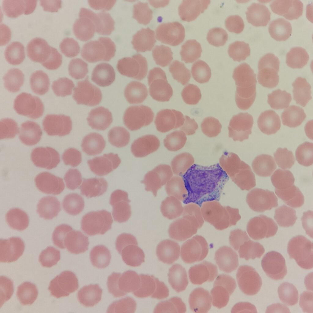 An immature neutrophil: myelocyte