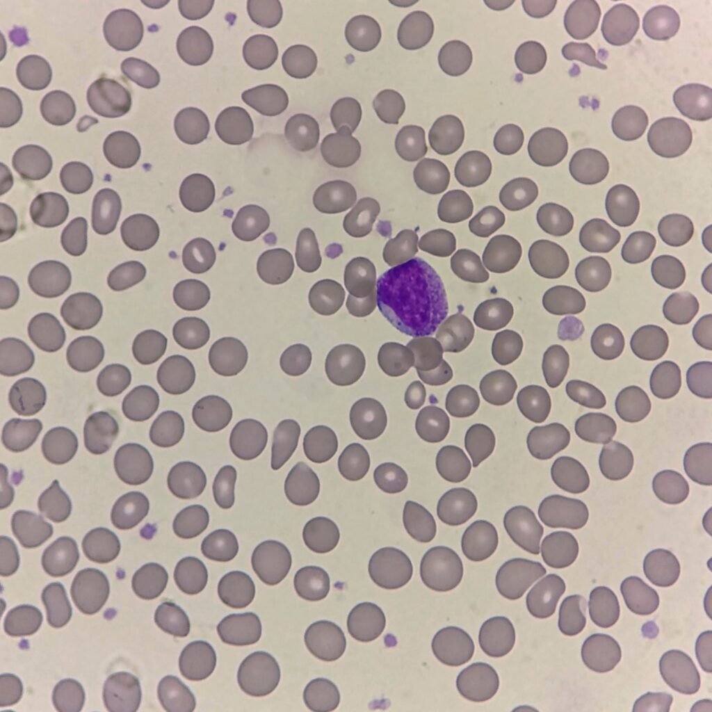 An immature neutrophil: myelocyte
