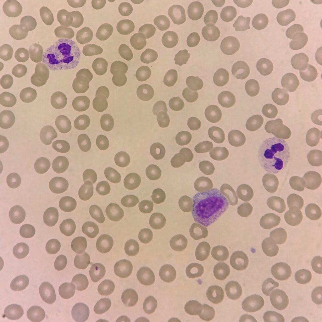 An immature neutrophil: myelocyte