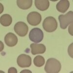 Red Blood Cell Lineage: Identification & Differentiation