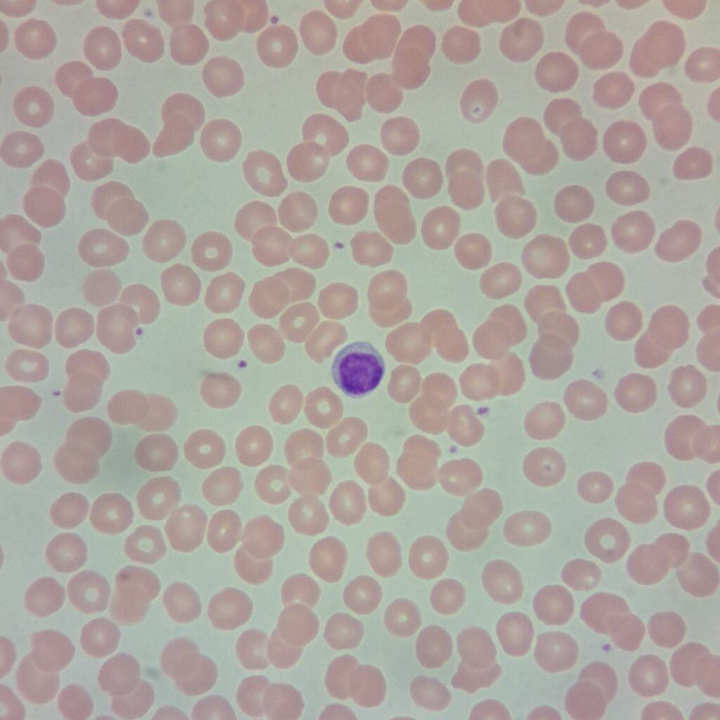 normocytic, normochromic RBCs