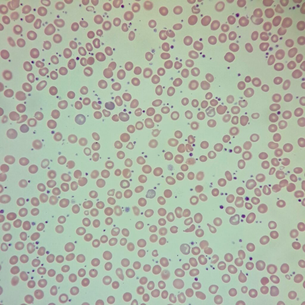 Polychromatophilic Morphology, RBCs with Polychromasia