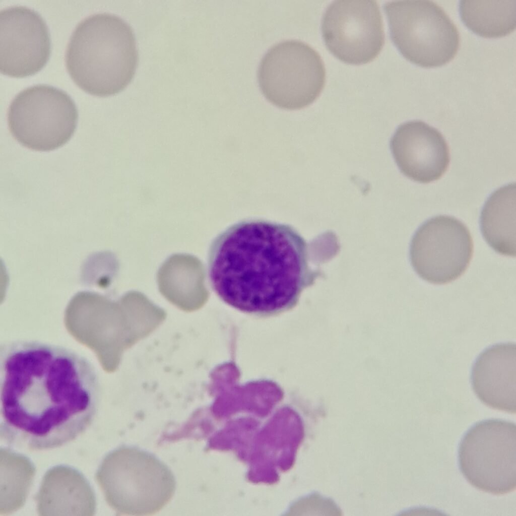 A type of nucleated red blood cell: Basophilic Normoblast (Prorubricyte)