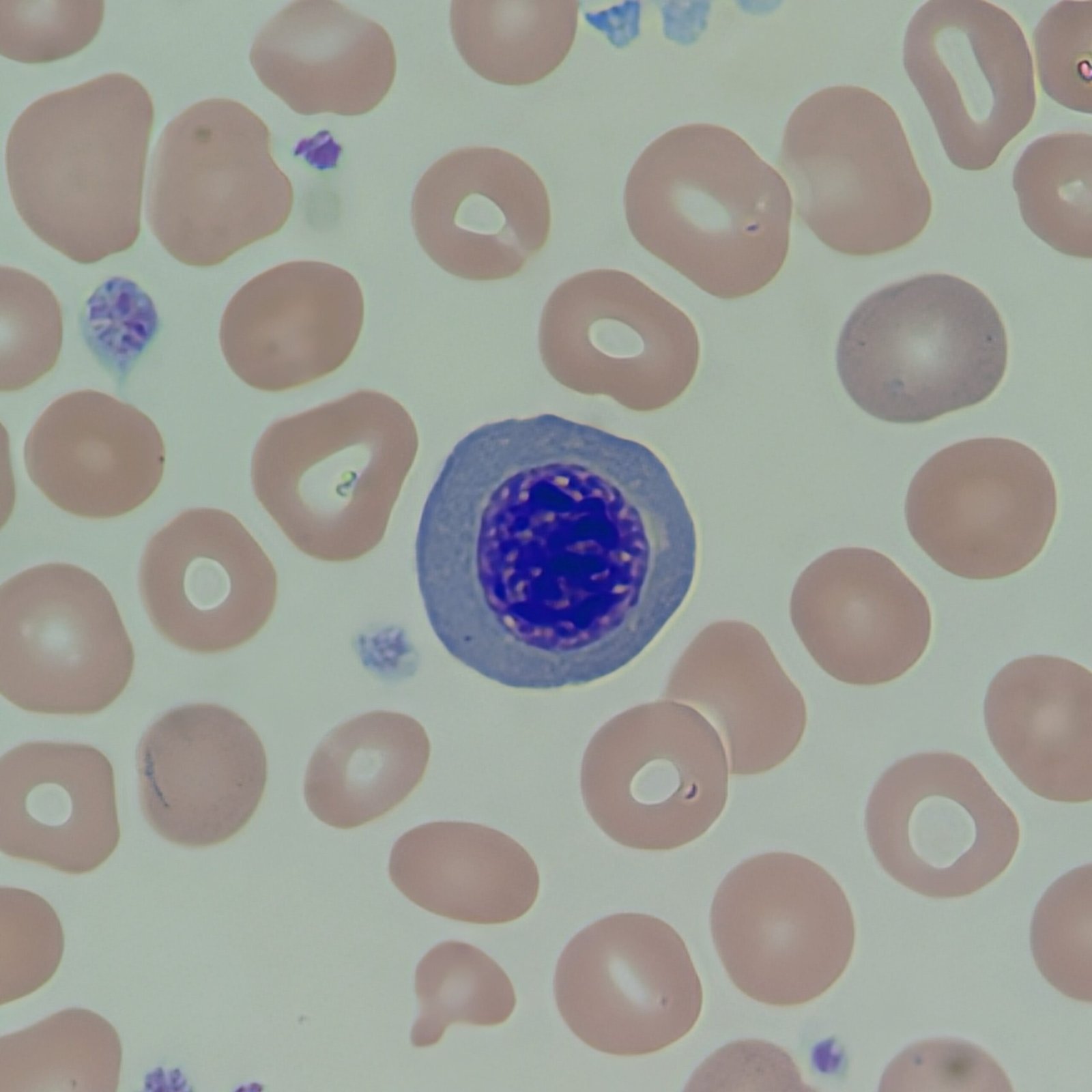 Nucleated Red Blood Cell, Prorubricyte