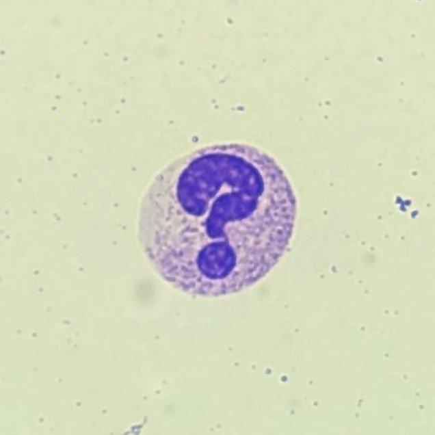 white blood cell: segmented neutrophil