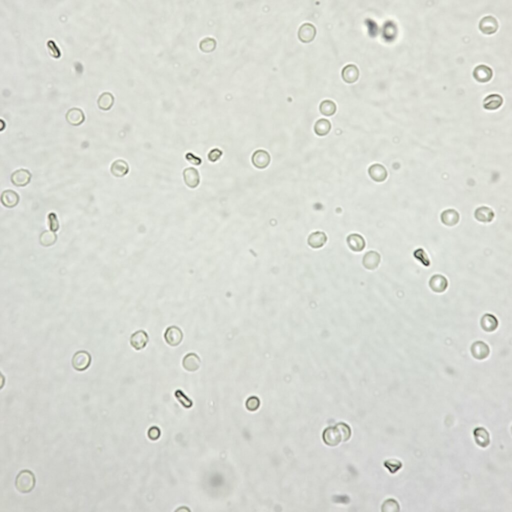 red blood cells in urine