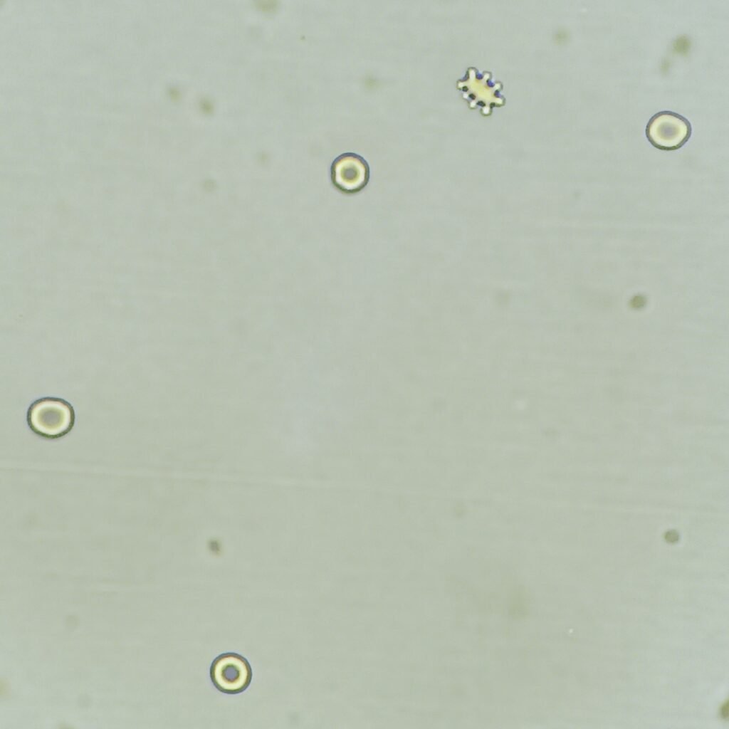 red blood cells in urine