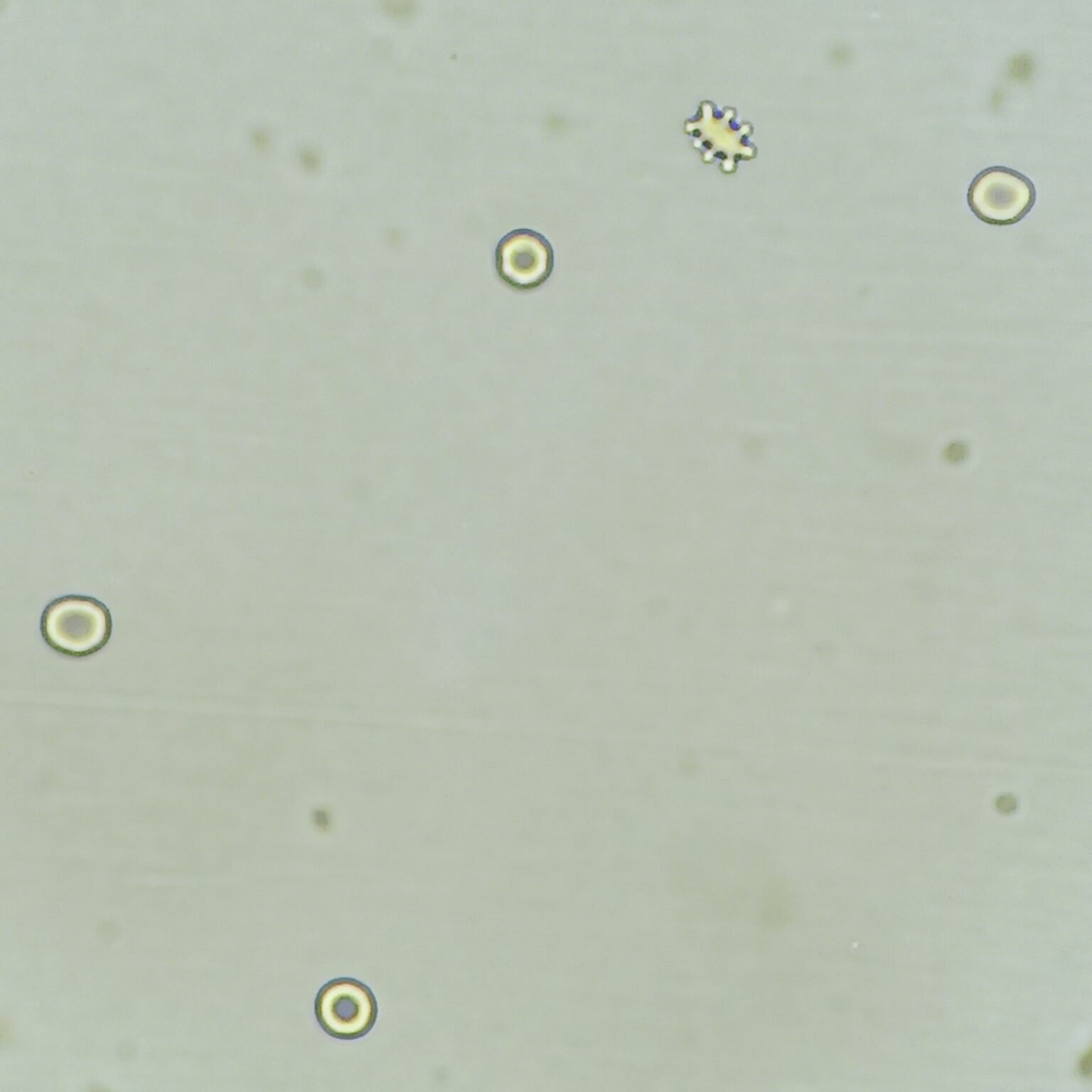 Gecko Rbcs RBCs in Urine & Their Lookalikes - MedLabBuddy