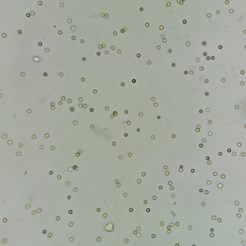 red blood cells in urine