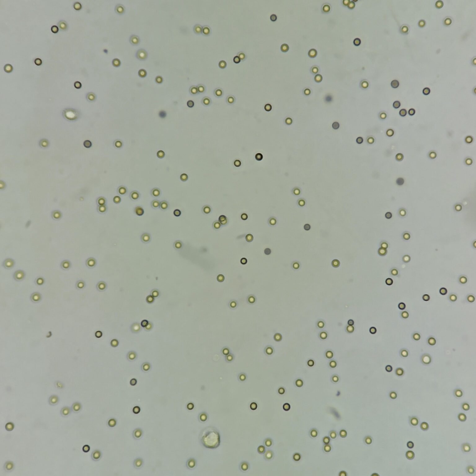 Bizzare Rbcs RBCs in Urine & Their Lookalikes - MedLabBuddy