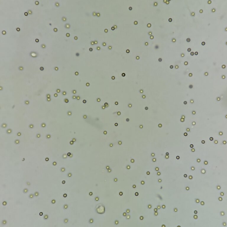 Usda Rbcs RBCs in Urine & Their Lookalikes - MedLabBuddy