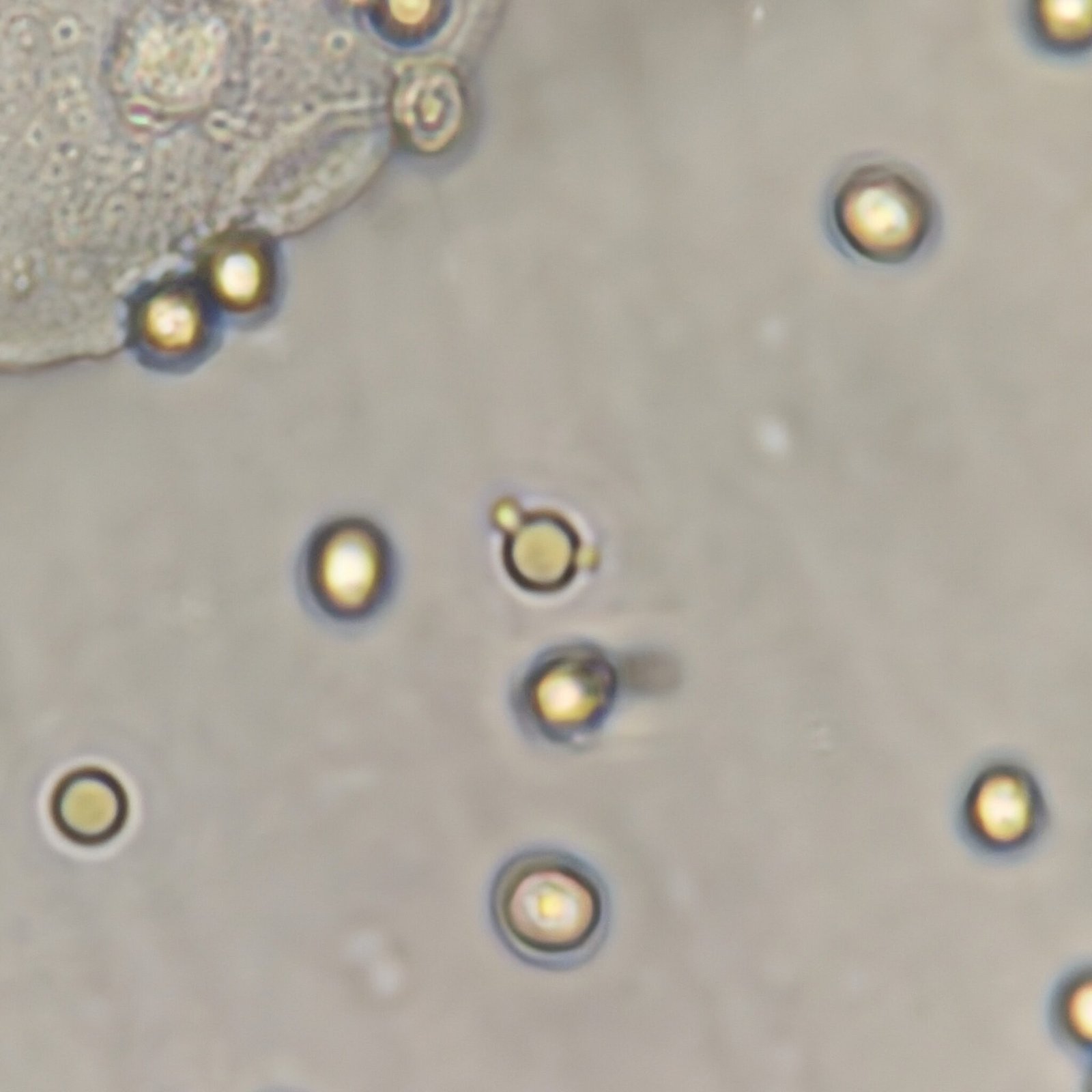 RBCs in Urine & Their Lookalikes - MedLabBuddy