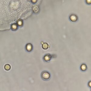 RBCs in Urine & Their Lookalikes - MedLabBuddy