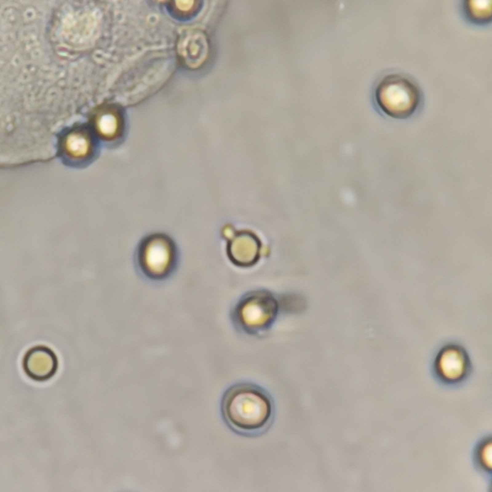 Red blood cells in urine