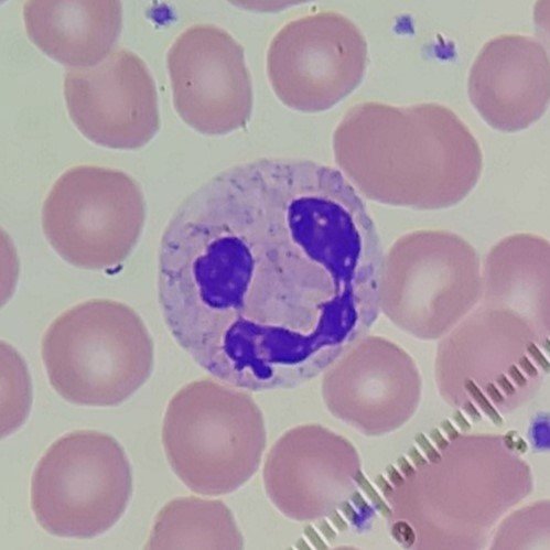 segmented neutrophil