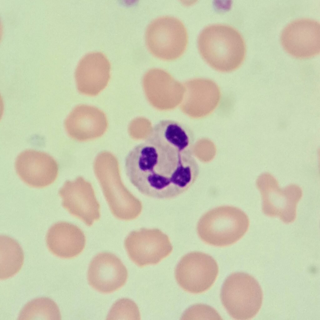segmented neutrophil