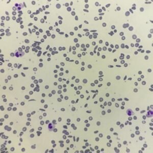 RBC Morphology Based on Shape