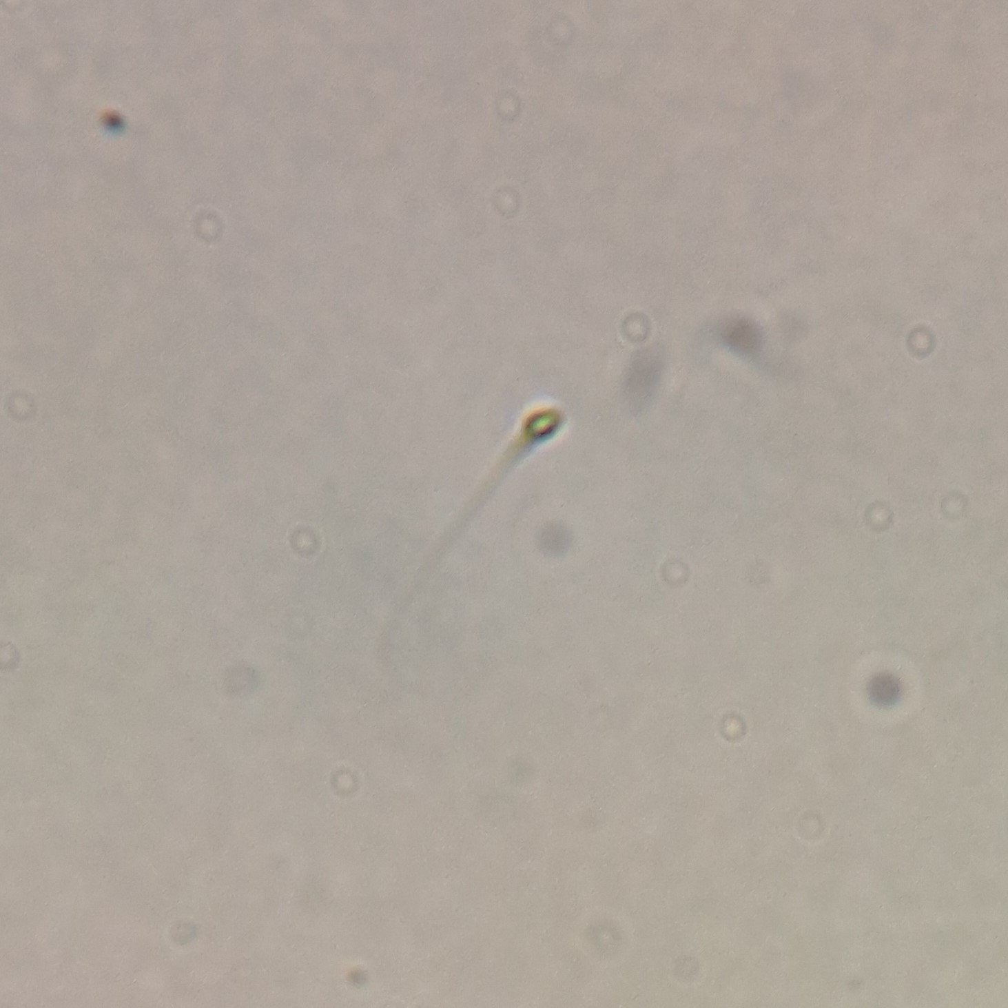 spermatozoa in urine
