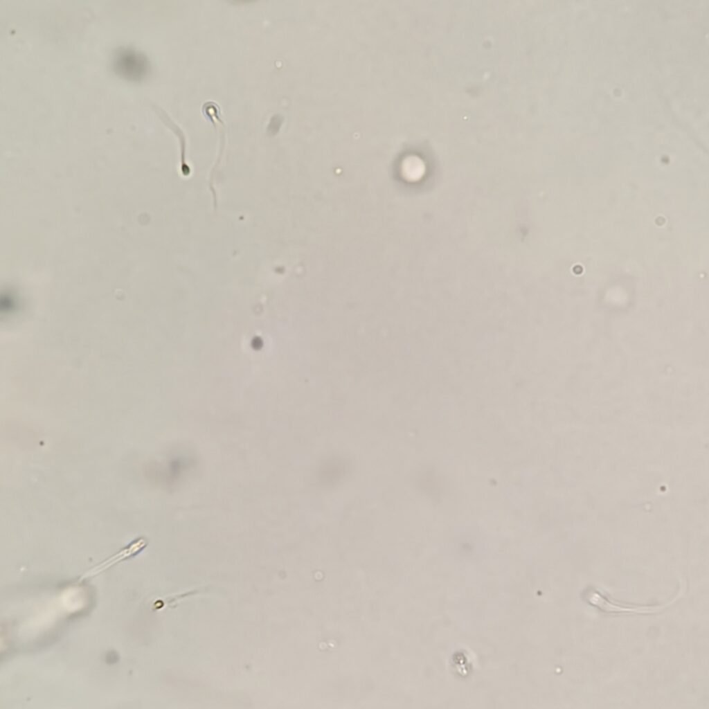 spermatozoa in urine