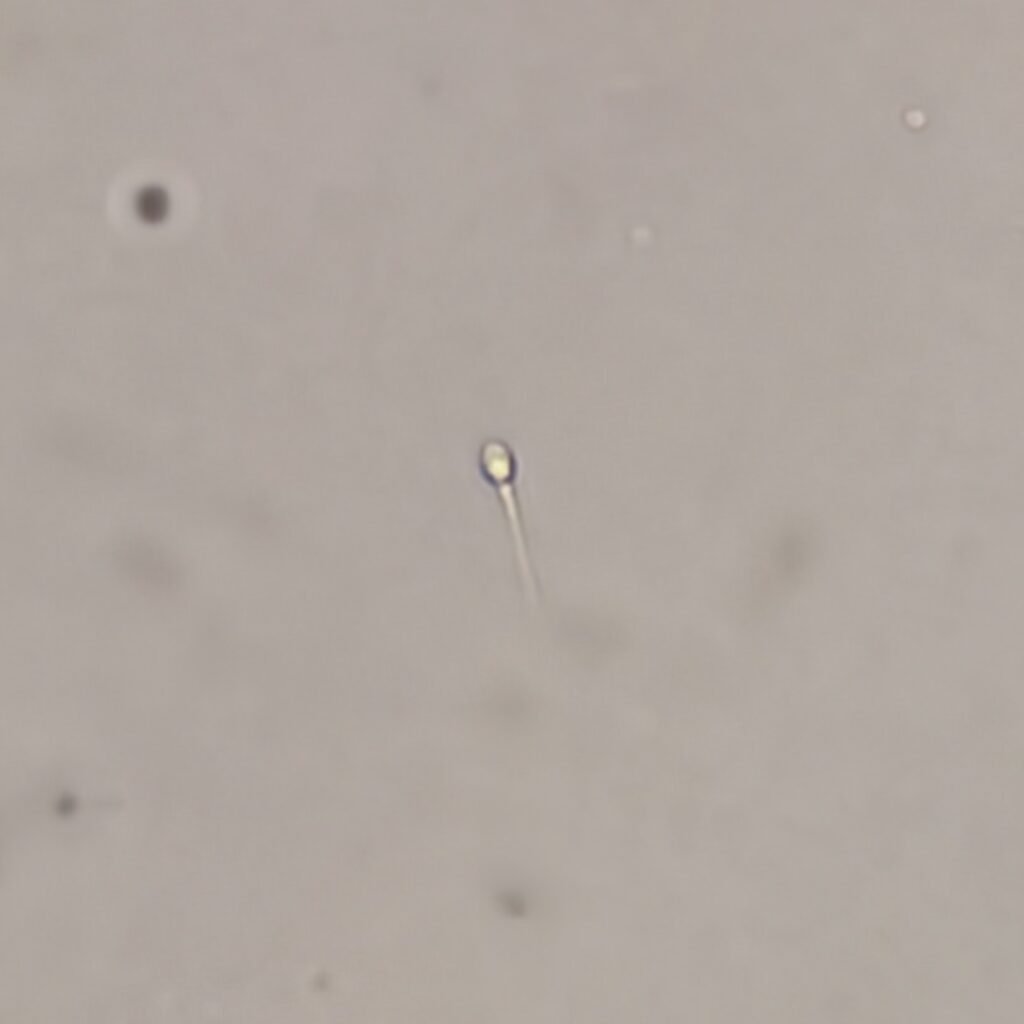 spermatozoa in urine
