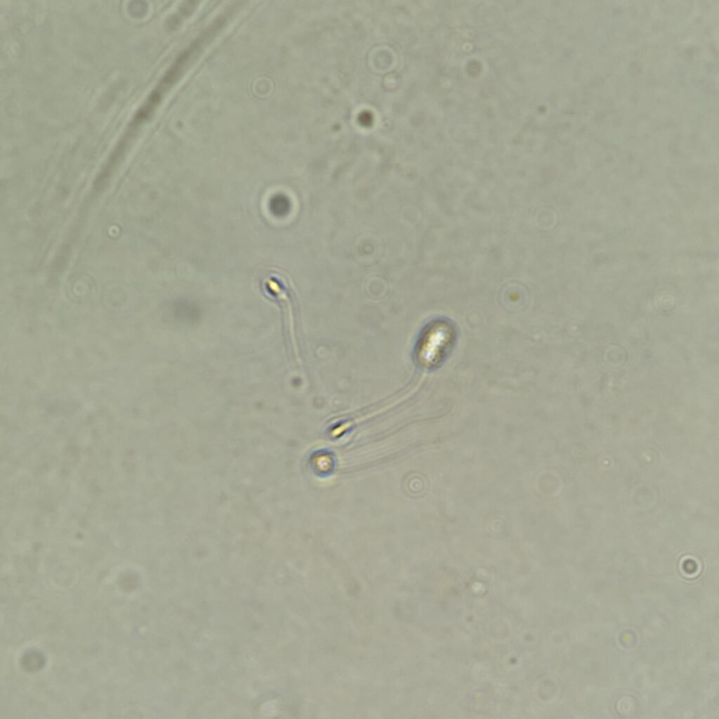 spermatozoa in urine microscopic